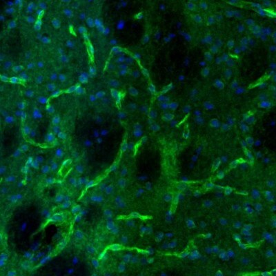 USP11 Antibody - BSA Free Immunohistochemistry-Paraffin: USP11 Antibody [NBP1-80639]