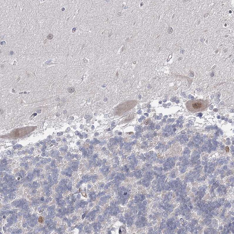 USP11 Antibody - BSA Free Immunohistochemistry-Paraffin: USP11 Antibody [NBP1-80639]