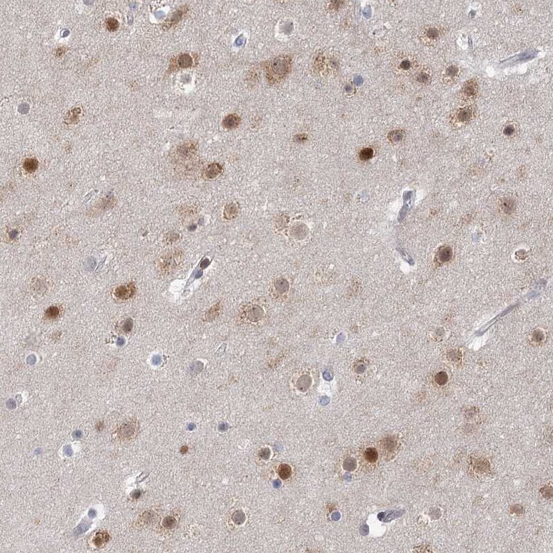 USP11 Antibody - BSA Free Immunohistochemistry-Paraffin: USP11 Antibody [NBP1-80639]