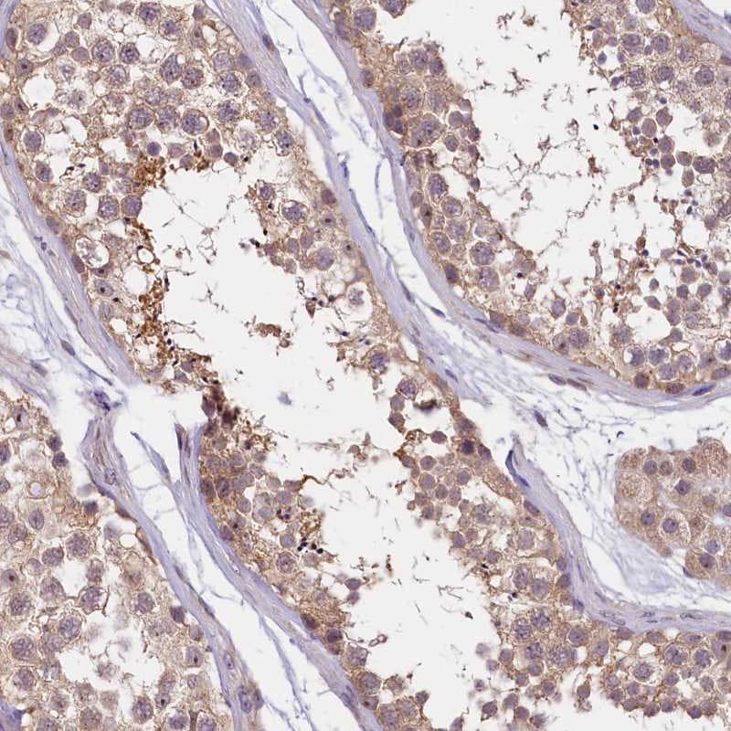 UBXN6 Antibody - BSA Free Immunohistochemistry: UBXN6 Antibody - BSA Free [NBP1-80649]
