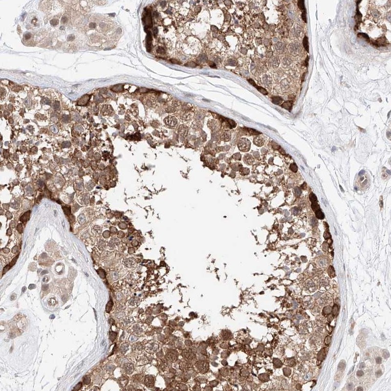 TRAX Antibody - BSA Free Immunohistochemistry-Paraffin: TRAX Antibody [NBP1-80666]