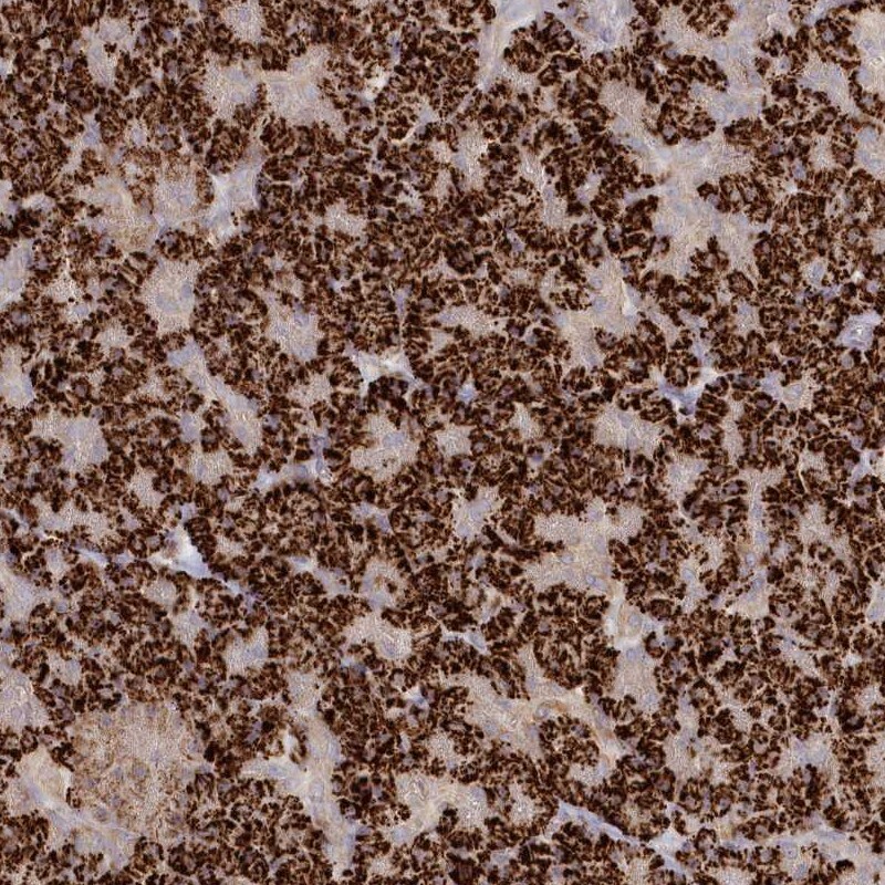 TGFBRAP1 Antibody - BSA Free Immunohistochemistry-Paraffin: TGFBRAP1 Antibody [NBP1-80668]