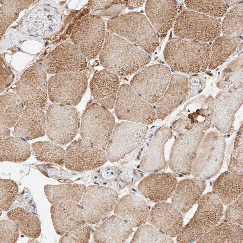 THTPA Antibody - BSA Free Immunohistochemistry-Paraffin: THTPA Antibody [NBP1-80686]