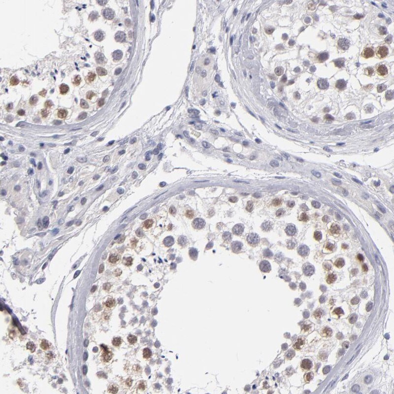 ZIP4H/Tex11 Antibody - BSA Free Immunohistochemistry: ZIP4H/Tex11 Antibody - BSA Free [NBP1-80692]