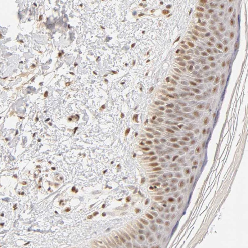 TAF10 Antibody - BSA Free Immunohistochemistry-Paraffin: TAF10 Antibody [NBP1-80706]