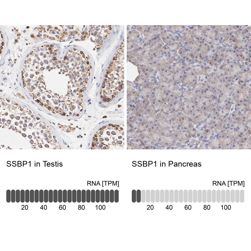SSBP1 Antibody - BSA Free Immunohistochemistry-Paraffin: SSBP1 Antibody [NBP1-80720]