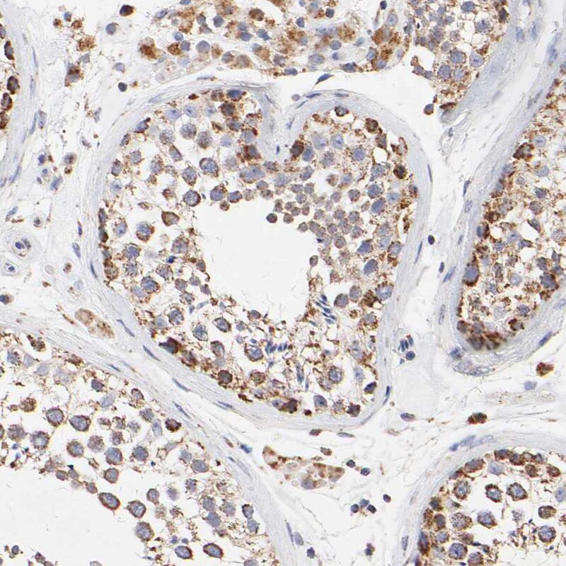 SSBP1 Antibody - BSA Free Immunohistochemistry-Paraffin: SSBP1 Antibody [NBP1-80720]