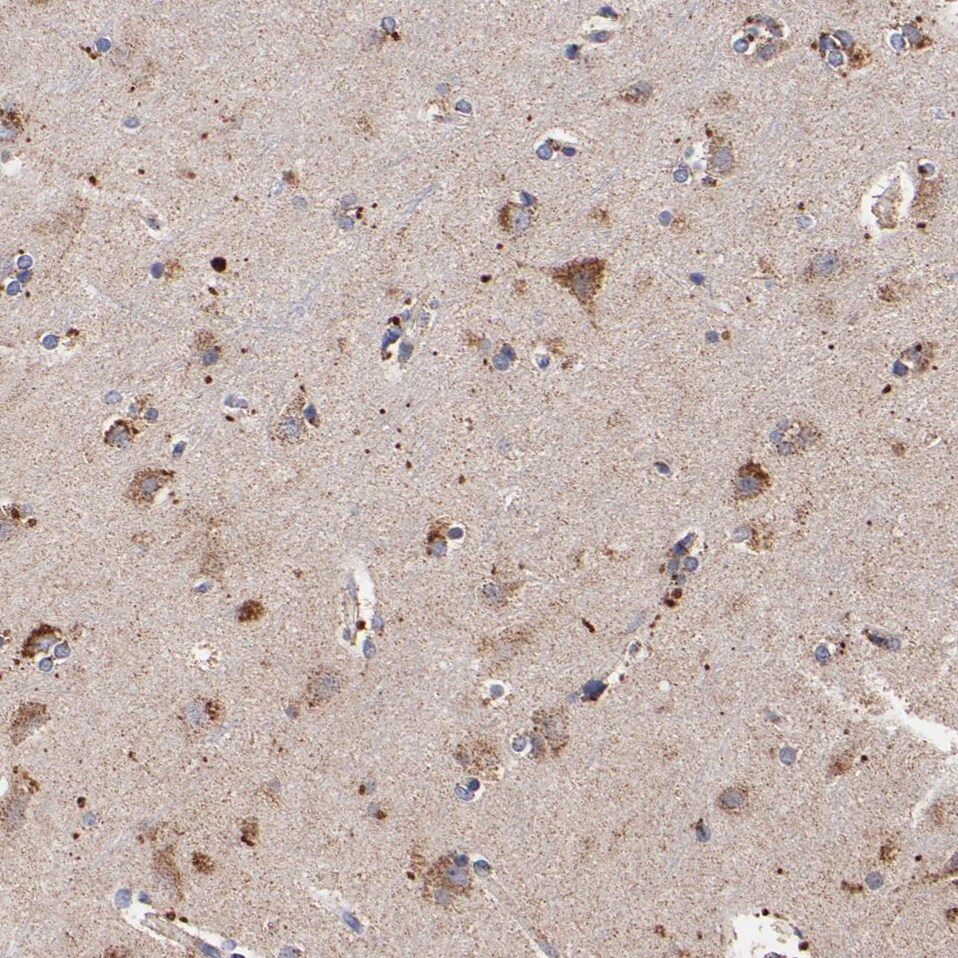 SSBP1 Antibody - BSA Free Immunohistochemistry-Paraffin: SSBP1 Antibody [NBP1-80720]
