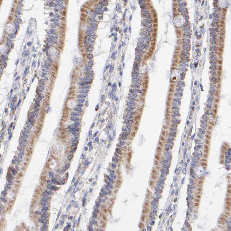 SSBP1 Antibody - BSA Free Immunohistochemistry-Paraffin: SSBP1 Antibody [NBP1-80720]