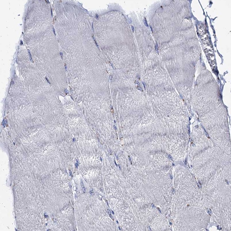 Tm9sf3 Antibody - BSA Free Immunohistochemistry-Paraffin: Tm9sf3 Antibody [NBP1-80736]