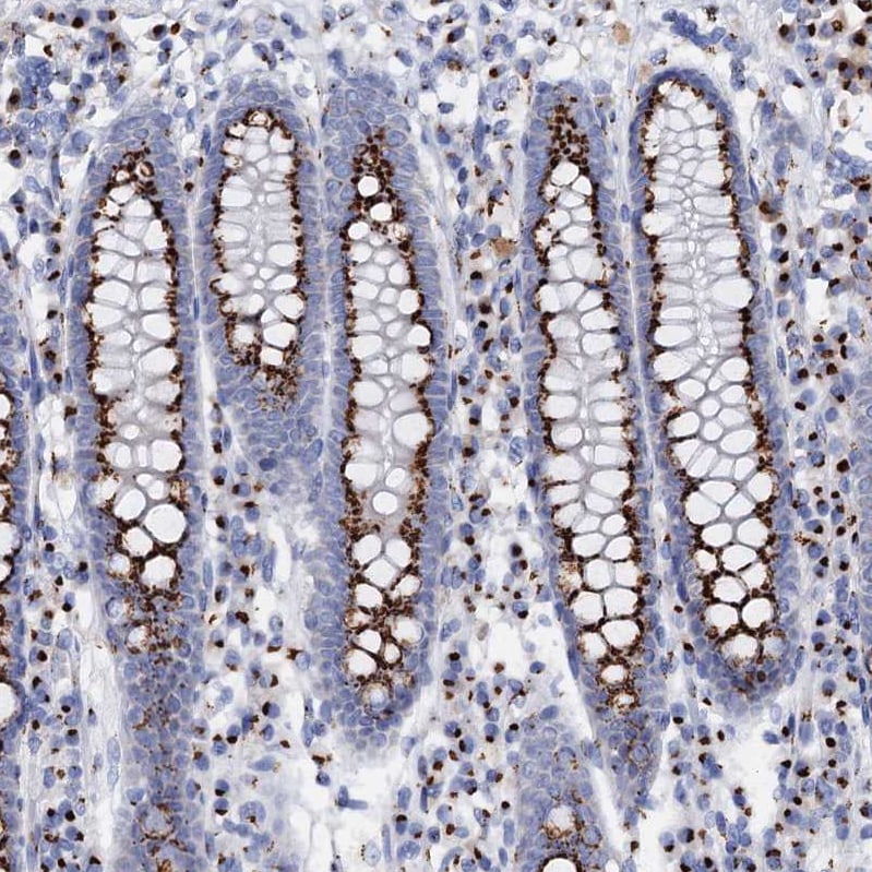 Tm9sf3 Antibody - BSA Free Immunohistochemistry-Paraffin: Tm9sf3 Antibody [NBP1-80736]