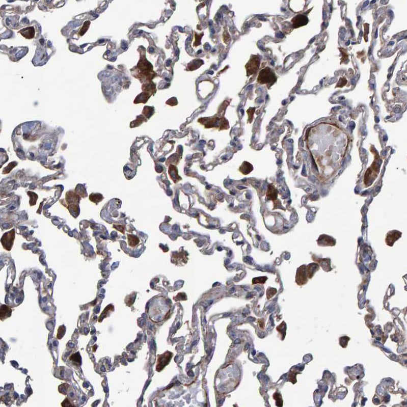 Slit2 Antibody - BSA Free Immunohistochemistry: Slit2 Antibody - BSA Free [NBP1-80742]
