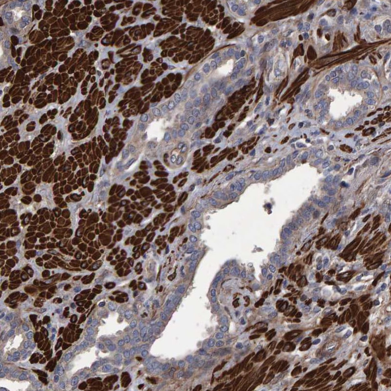 Slit2 Antibody - BSA Free Immunohistochemistry: Slit2 Antibody - BSA Free [NBP1-80742]