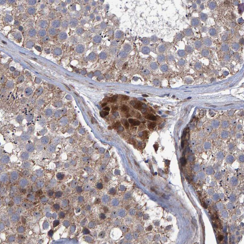 Slit2 Antibody - BSA Free Immunohistochemistry: Slit2 Antibody - BSA Free [NBP1-80742]