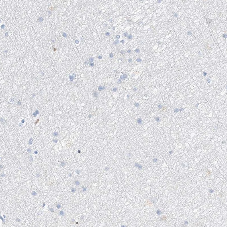 Serine protease 23 Antibody - BSA Free Immunohistochemistry: Serine protease 23 Antibody - BSA Free [NBP1-80748]