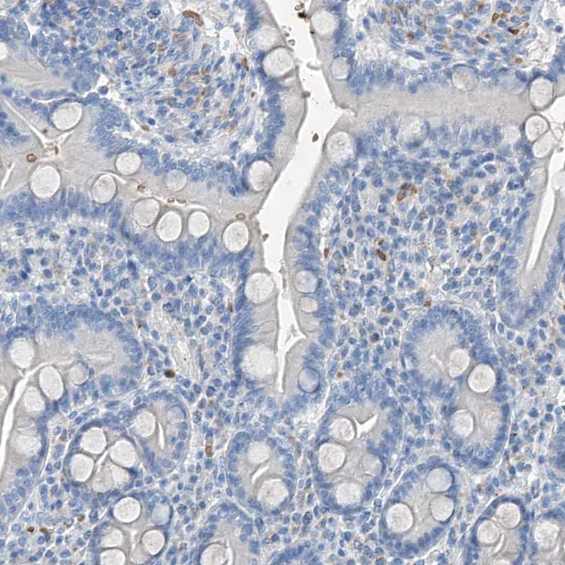 Serine protease 23 Antibody - BSA Free Immunohistochemistry: Serine protease 23 Antibody - BSA Free [NBP1-80748]