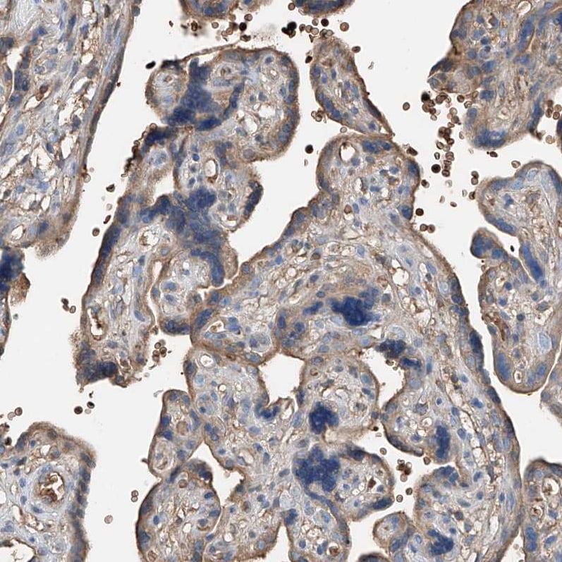 Serine protease 23 Antibody - BSA Free Immunohistochemistry: Serine protease 23 Antibody - BSA Free [NBP1-80748]