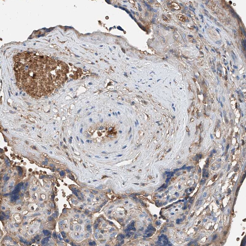 Serine protease 23 Antibody - BSA Free Immunohistochemistry: Serine protease 23 Antibody - BSA Free [NBP1-80748]