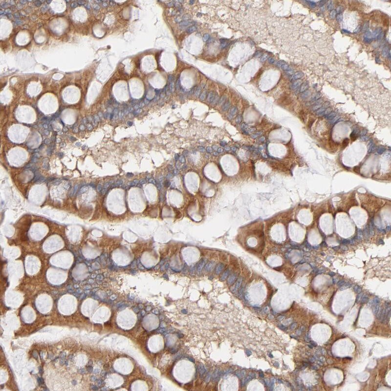 SG2NA Antibody - BSA Free Immunohistochemistry-Paraffin: SG2NA Antibody [NBP1-80763]
