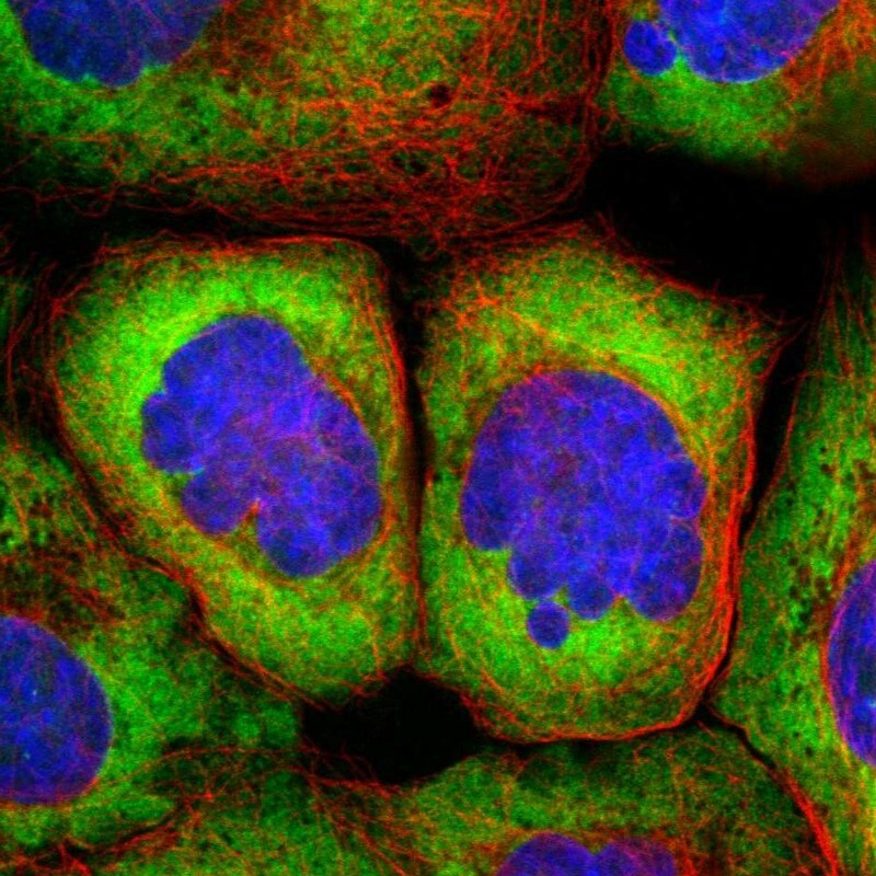 RPS25 Antibody - BSA Free Immunocytochemistry/ Immunofluorescence: RPS25 Antibody [NBP1-80802]