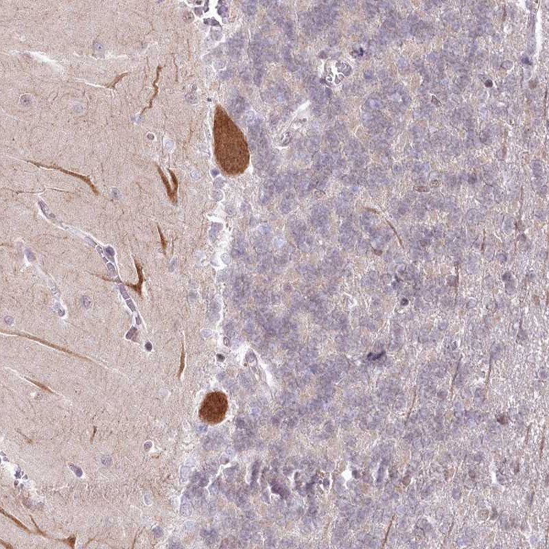 AMTN Antibody - BSA Free Immunohistochemistry: AMTN Antibody - BSA Free [NBP1-80809]