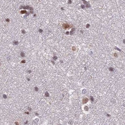 POLR2C Antibody - BSA Free Immunohistochemistry-Paraffin: POLR2C Antibody [NBP1-80817]