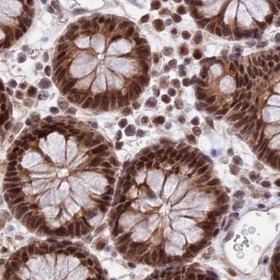POLR2C Antibody - BSA Free Immunohistochemistry-Paraffin: POLR2C Antibody [NBP1-80817]