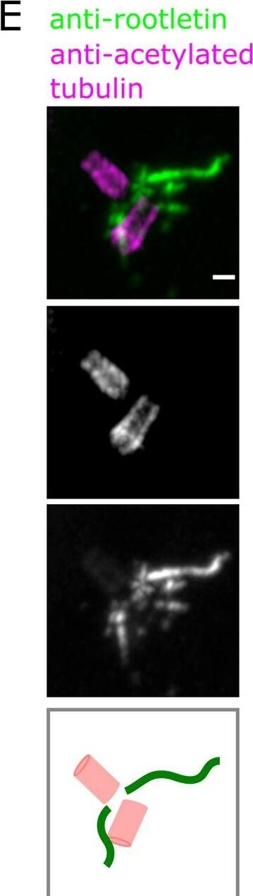 CROCC Antibody - BSA Free