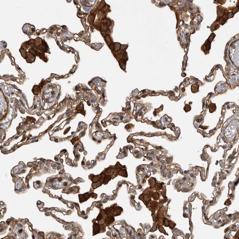 TRIM56 Antibody - BSA Free Immunohistochemistry-Paraffin: TRIM56 Antibody [NBP1-80829]