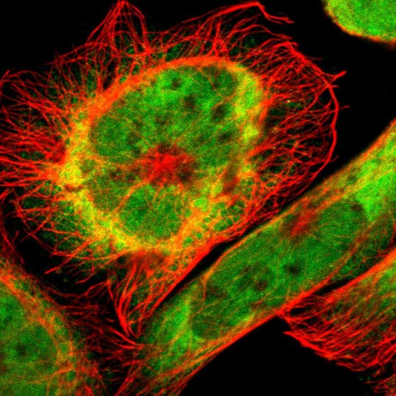 RING1 Antibody - BSA Free Immunocytochemistry/ Immunofluorescence: RING1 Antibody [NBP1-80830]
