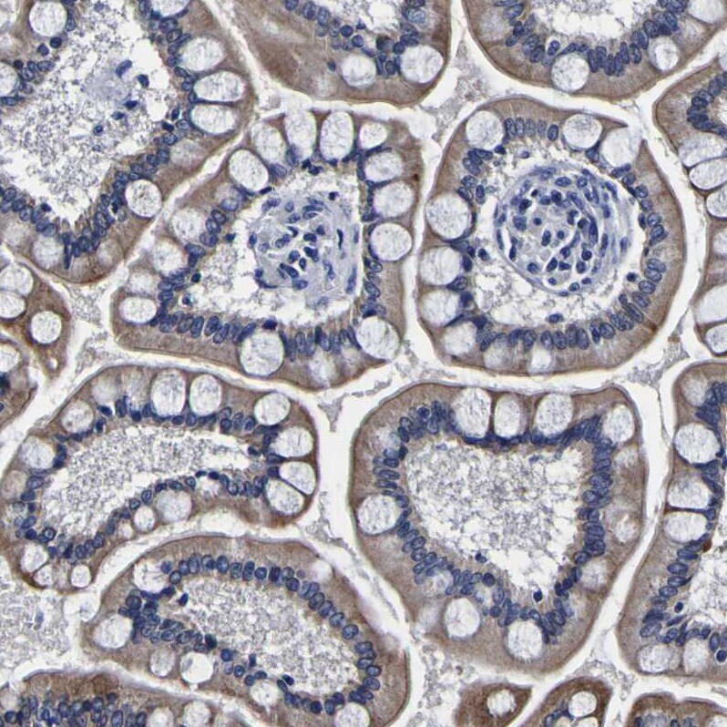 PDLIM4 Antibody - BSA Free Immunohistochemistry-Paraffin: PDLIM4 Antibody [NBP1-80833]