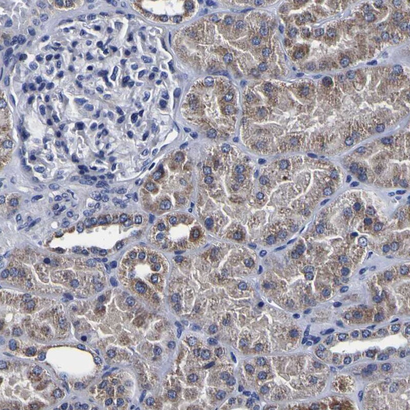 PDLIM4 Antibody - BSA Free Immunohistochemistry-Paraffin: PDLIM4 Antibody [NBP1-80833]