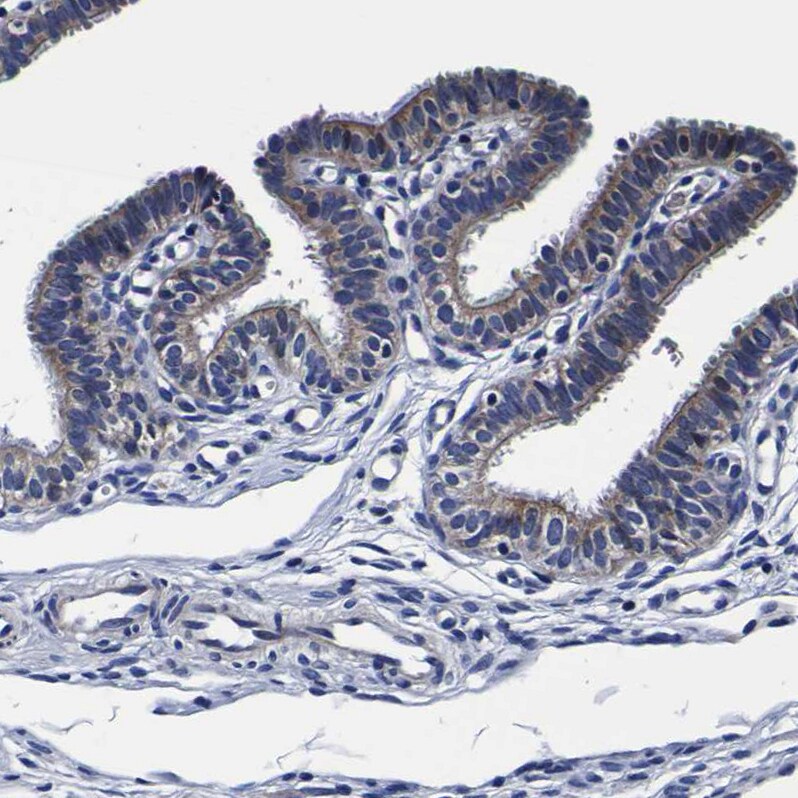 PDLIM4 Antibody - BSA Free Immunohistochemistry-Paraffin: PDLIM4 Antibody [NBP1-80833]