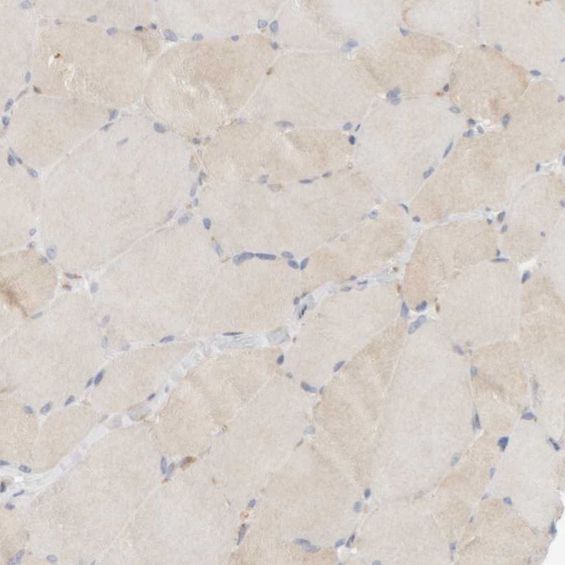 Ribophorin II Antibody - BSA Free Immunohistochemistry-Paraffin: Ribophorin II Antibody [NBP1-80835]