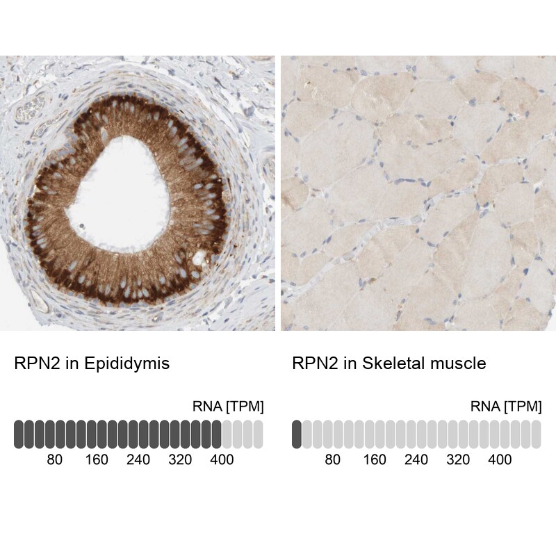 Ribophorin II Antibody - BSA Free Immunohistochemistry-Paraffin: Ribophorin II Antibody [NBP1-80835]