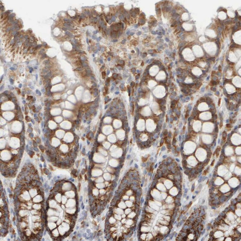 Ribophorin II Antibody - BSA Free Immunohistochemistry-Paraffin: Ribophorin II Antibody [NBP1-80835]