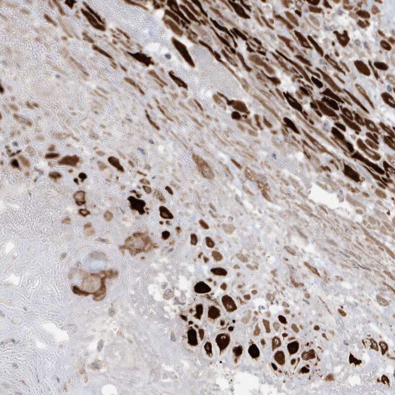 RGL4 Antibody - BSA Free Immunohistochemistry-Paraffin: RGL4 Antibody [NBP1-80840]