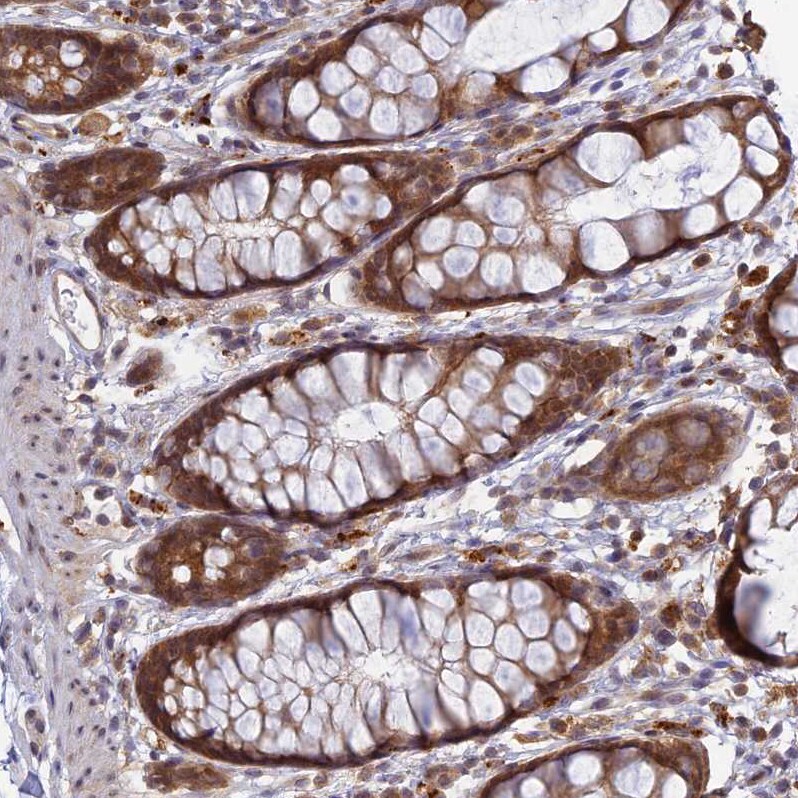 WDR61 Antibody - BSA Free Immunohistochemistry-Paraffin: WDR61 Antibody [NBP1-80844]
