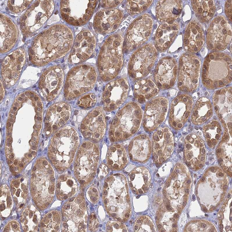 WDR61 Antibody - BSA Free Immunohistochemistry-Paraffin: WDR61 Antibody [NBP1-80844]