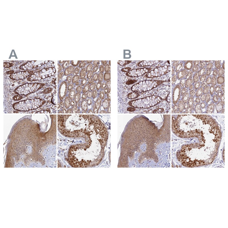WDR61 Antibody - BSA Free Immunohistochemistry-Paraffin: WDR61 Antibody [NBP1-80844]