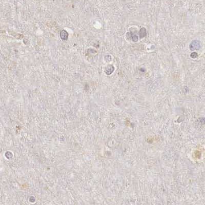 RENBP Antibody - BSA Free Immunohistochemistry: RENBP Antibody - BSA Free [NBP1-80852]