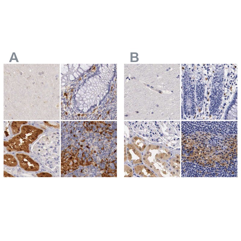 RENBP Antibody - BSA Free Immunohistochemistry: RENBP Antibody - BSA Free [NBP1-80852]