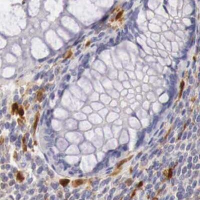 RENBP Antibody - BSA Free Immunohistochemistry: RENBP Antibody - BSA Free [NBP1-80852]