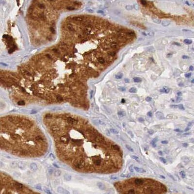 RENBP Antibody - BSA Free Immunohistochemistry: RENBP Antibody - BSA Free [NBP1-80852]