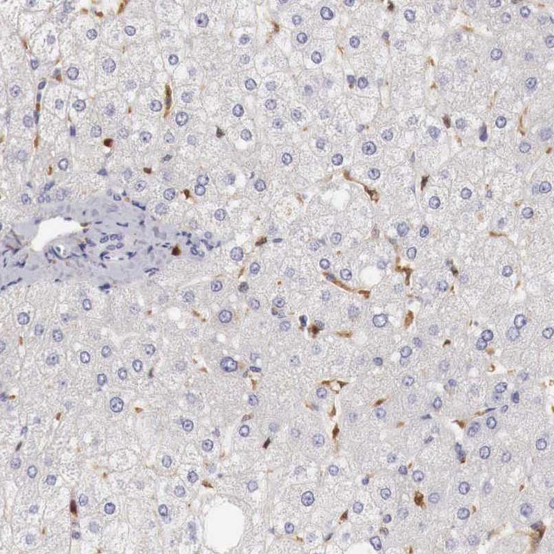 RENBP Antibody - BSA Free Immunohistochemistry: RENBP Antibody - BSA Free [NBP1-80852]