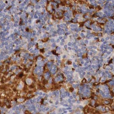RENBP Antibody - BSA Free Immunohistochemistry: RENBP Antibody - BSA Free [NBP1-80852]