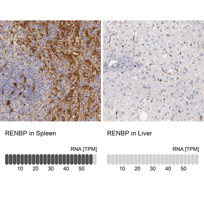 RENBP Antibody - BSA Free Immunohistochemistry: RENBP Antibody - BSA Free [NBP1-80852]