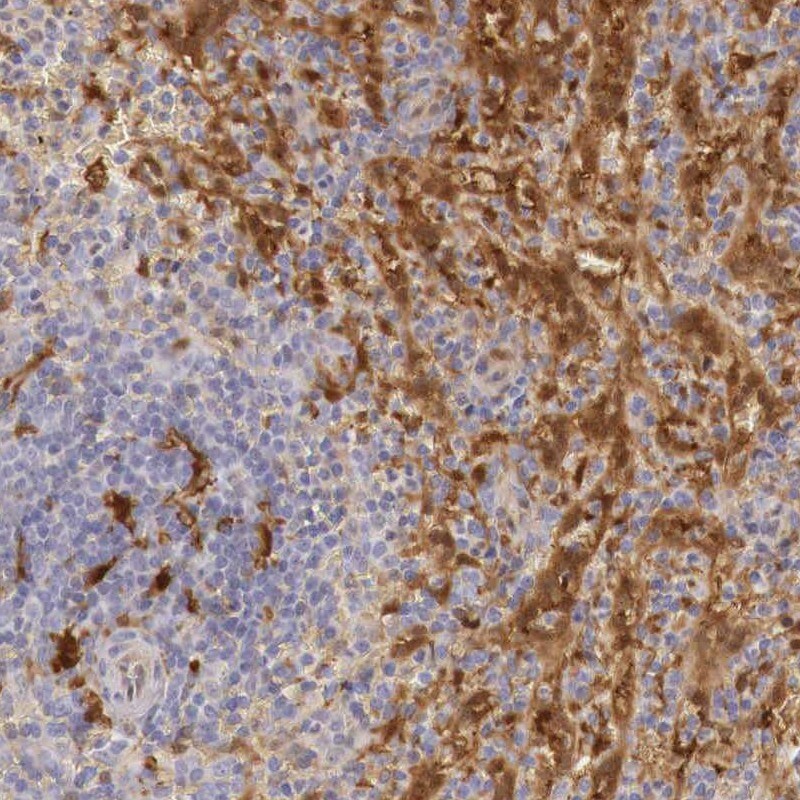 RENBP Antibody - BSA Free Immunohistochemistry: RENBP Antibody - BSA Free [NBP1-80852]