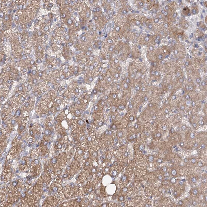 RIN2 Antibody - BSA Free Immunohistochemistry-Paraffin: RIN2 Antibody [NBP1-80854]