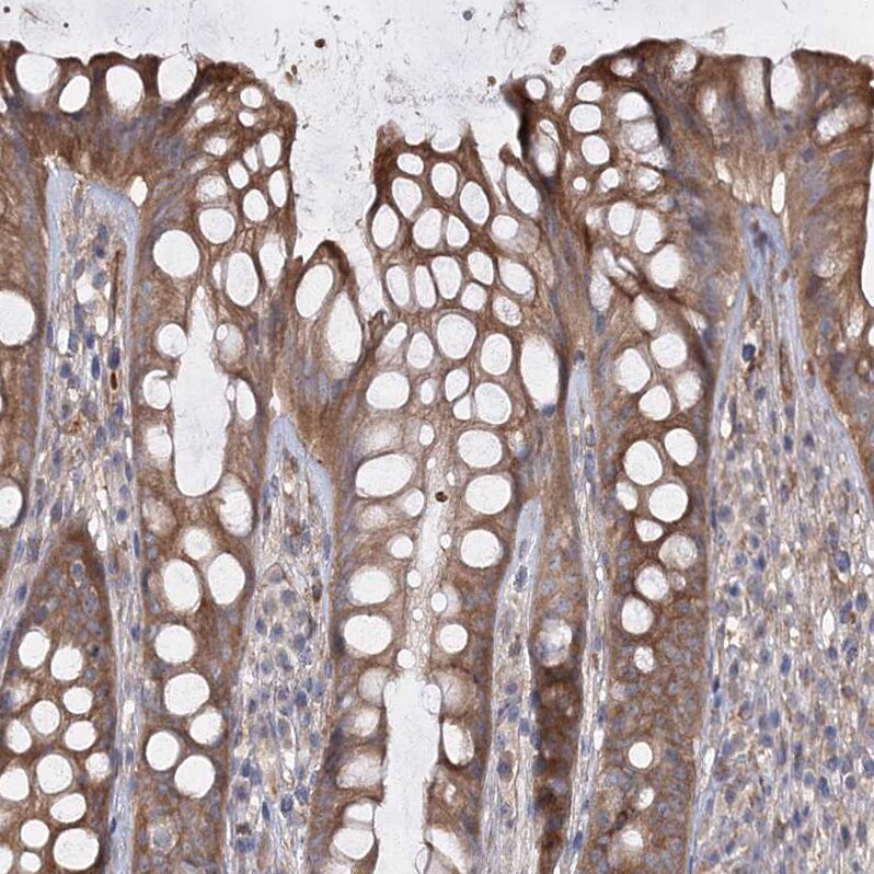 RIN2 Antibody - BSA Free Immunohistochemistry-Paraffin: RIN2 Antibody [NBP1-80854]
